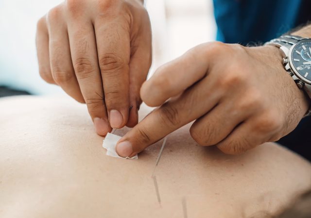 Woman stabbed in the back with needle in bright acupuncture clinic. High quality photo